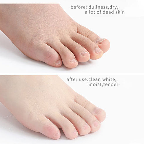Foot Peeling Spray with Orange Oil Essence for Dead Skin Exfoliation
