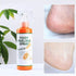 Foot Peeling Spray with Orange Oil Essence for Dead Skin Exfoliation